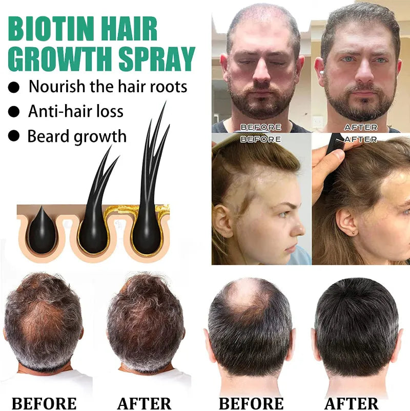 Hair Growth Products Biotin Fast Growing Hair Compliance Care Essential Oils Anti Hair Loss Spray Scalp Dry Treatment Men Women