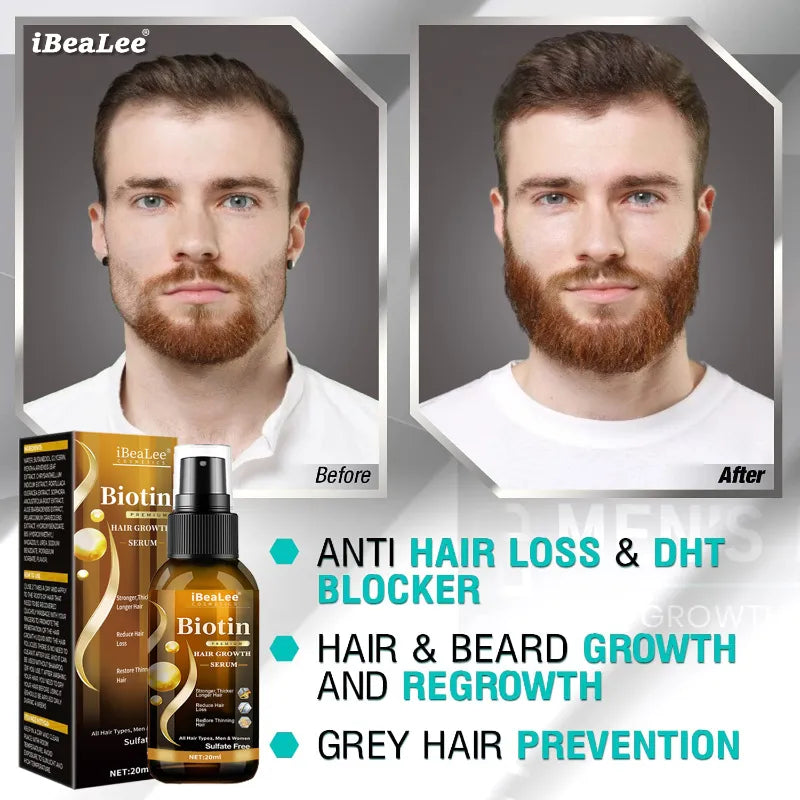 Hair Growth Products Biotin Fast Growing Hair Compliance Care Essential Oils Anti Hair Loss Spray Scalp Dry Treatment Men Women
