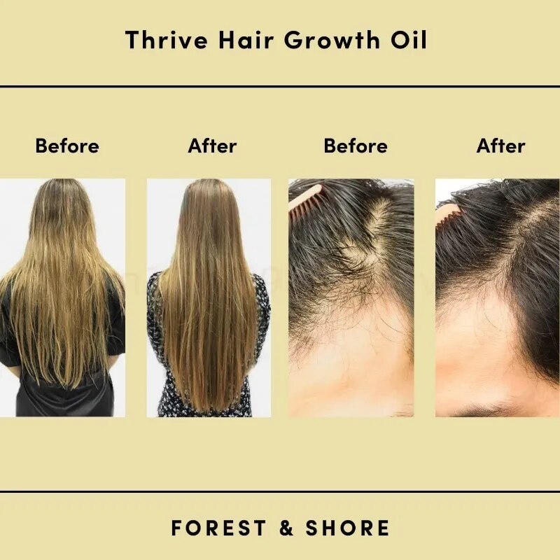 Hair Growth rosemary Oil Prevent Hair Loss Essential Oil Fast Growing Scalp Treatment Beauty Health For Men Women Repair Damage
