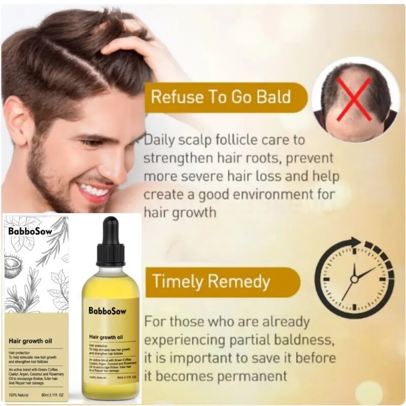 Hair Growth rosemary Oil Prevent Hair Loss Essential Oil Fast Growing Scalp Treatment Beauty Health For Men Women Repair Damage